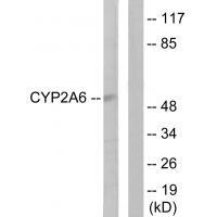 Cytochrome P452A6
