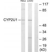 Cytochrome P452U1
