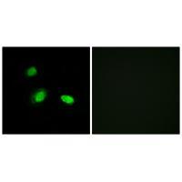 Rabbit Polyclonal Antibody to HSPB2