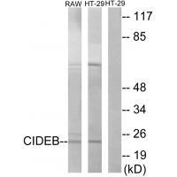 CIDEB