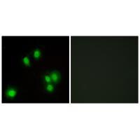 Rabbit Polyclonal Antibody to GA45G