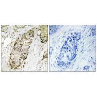 Rabbit Polyclonal Antibody to GA45G