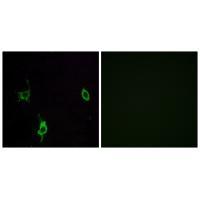 Rabbit Polyclonal Antibody to LAMC3
