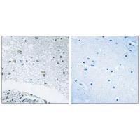Rabbit Polyclonal Antibody to LAMC3