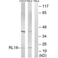 RPL18