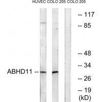 ABHD11