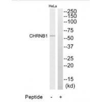 CHRNB1