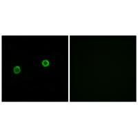 Rabbit Polyclonal Antibody to ACOT4