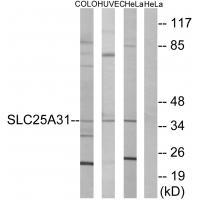 SLC25A31