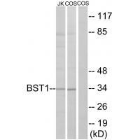 BST1