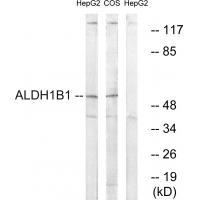ALDH1B1
