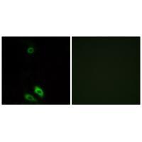 AKR1CL1