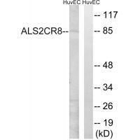 ALS2CR8
