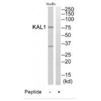 KAL1