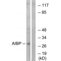 AIBP