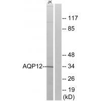 AQP12