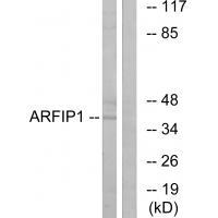 ARFIP1