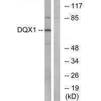 DQX1
