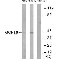 GCNT6