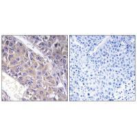 Rabbit Polyclonal Antibody to B4GALT3