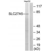 SLC27A5