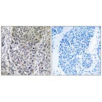Rabbit Polyclonal Antibody to BRP16