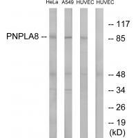 PNPLA8