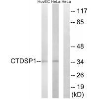 CTDSP1