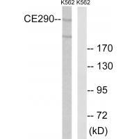 CEP29