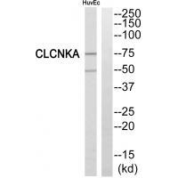 CLCNKA