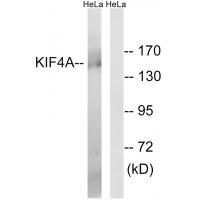 KIF4A