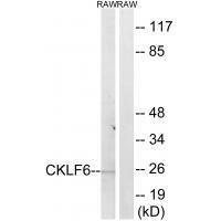 CKLF6