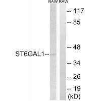 ST6GAL1