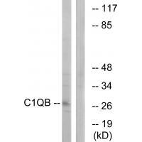 C1QB