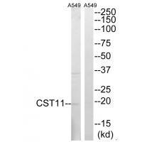 CST11
