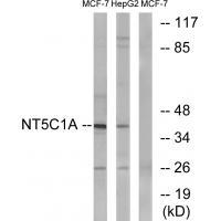 NT5C1A