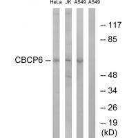 CBCP6