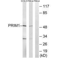 PRIM1