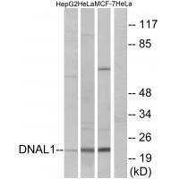 DNAL1
