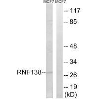 RNF138