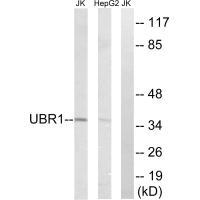 UBR1