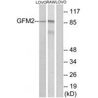 GFM2