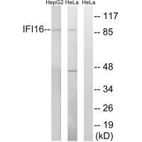 IFI16