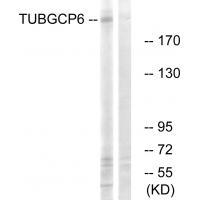 TUBGCP6