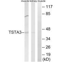 TSTA3