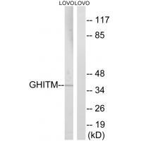 GHITM