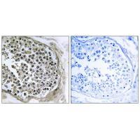 Rabbit Polyclonal Antibody to GIDRP88