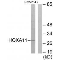HOXA11/D11
