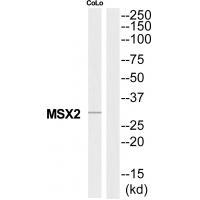 MSX2