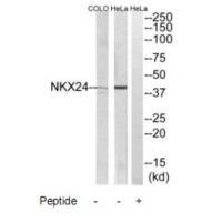NKX24